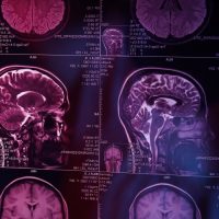 Brain Injury and Spinal Injury Claims After High-Speed Crashes Medical Proof Insurers Look For in 2026 Brain Injury and Spinal Injury Claims After High-Speed Crashes Medical Proof Insurers Look For in 2026